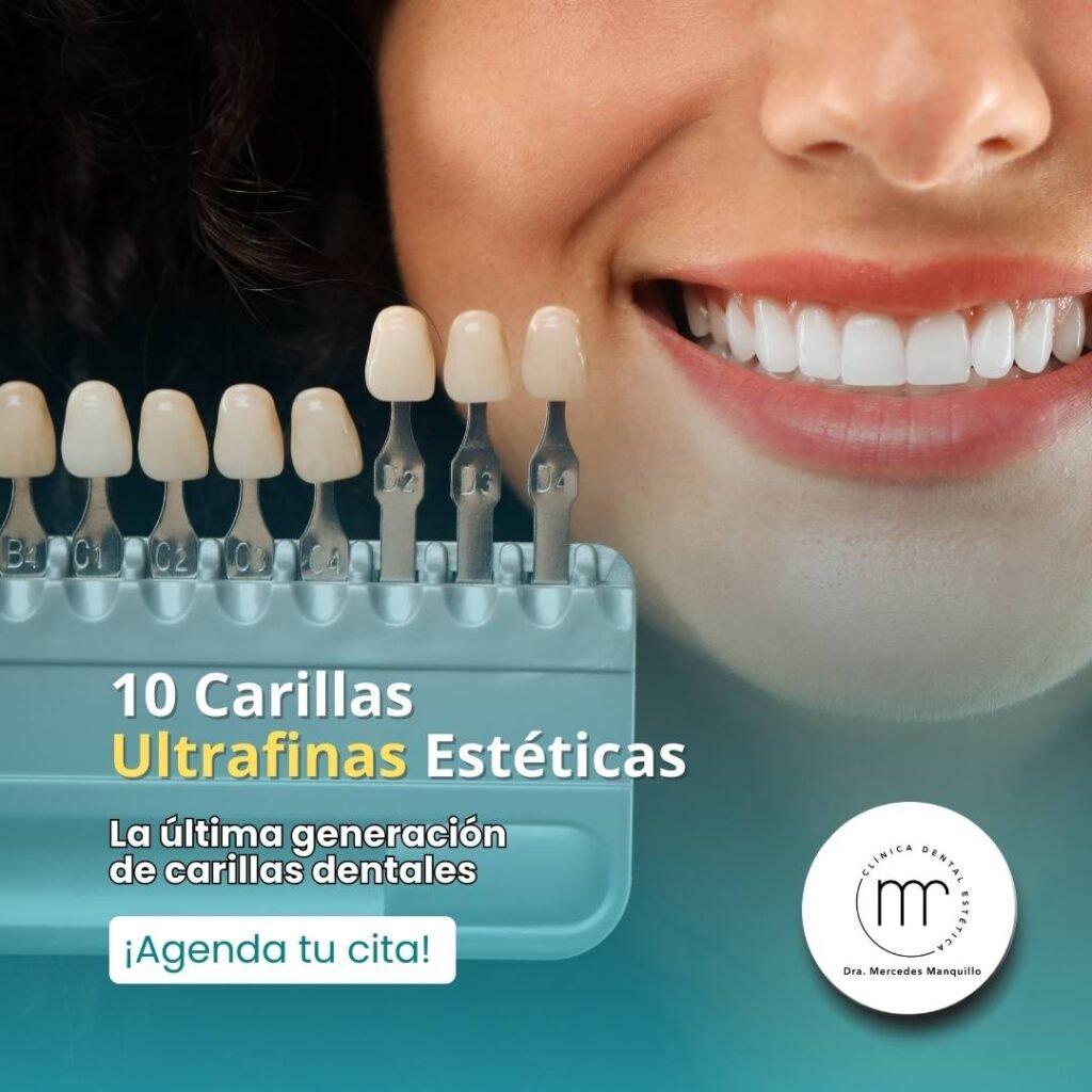 10 Carillas Ultrafinas Estéticas